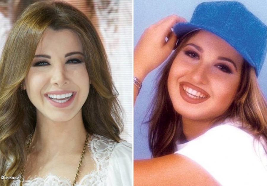 Nancy Ajram a subi plusieurs interventions chirurgicales qu'elle estime suffisantes Nancy Ajram a subi plusieurs interventions chirurgicales qu'elle estime suffisantes